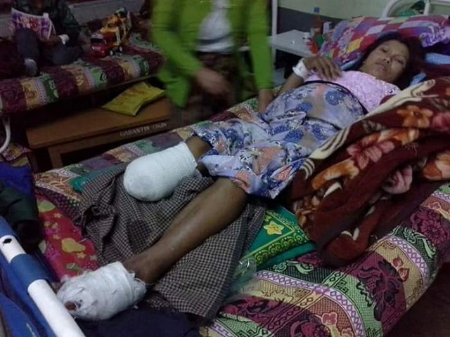 01 16 2017 Nang Khin Than Nu injured by Burma Army aerial bombing
