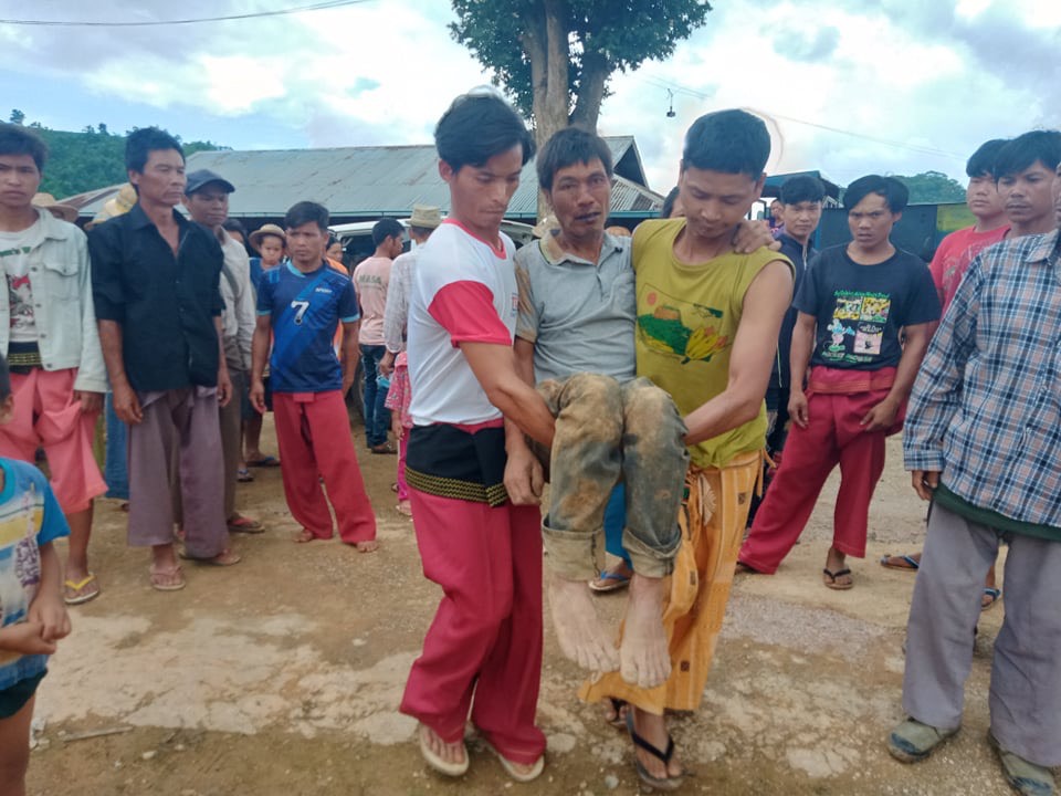 Aik Maung sustained serious injuries from the attack by the Burma Army