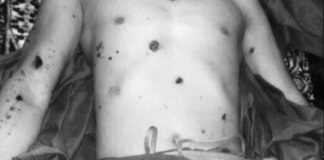 Buddhist Abbot And Villager Killed By Landmine The abbot was killed on the spot after suffering injuries all over his body