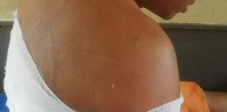 Unidentified Gunmen Attack Civilians Driving Through Kyaukme Aik Saw got gunshot injuries at Kyauk Mae