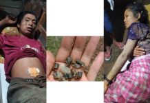 IDPs Wounded By Landmine In Kyaukme Township A man and woman were injured after stepping on a landmine at Kyautme