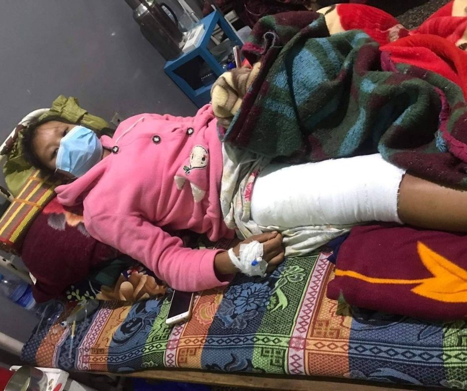 Nang Mo Khao and her sister stepped on a landmine on 12 February 2022 in Lawksawk township Southern Shan State