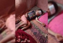 Sickness Affects Children In Kutkai IDP Camp feature idp