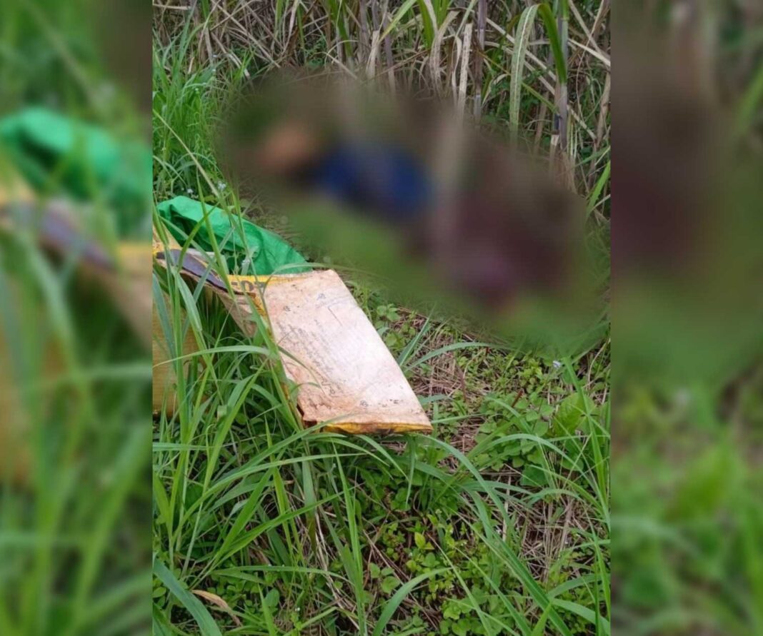 Landmine victim in Kyaukme Township Landmine victim in Kyaukme Township