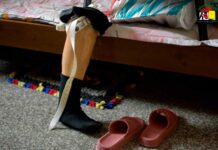 Landmines Kill 3, Injure 7 in Loikaw as IDPs Return Home A prosthetic leg provided to a civilian maimed by Myanmar’s civil war